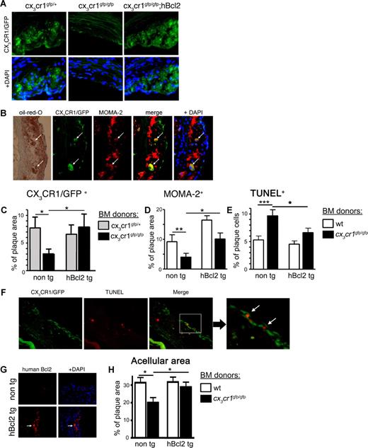 Figure 4. CX3CR1-deficient atheromas show changes in cellular composition and increased apoptosis. Irradiated apoe−/− recipients of indicated BM cells were subjected to high-fat diet for 12 weeks, after which their plaque content was analyzed. (A) Histology of atherosclerotic plaque of representative recipient of cx3cr1gfp/+, cx3cr1gfp/gfp, and cx3cr1gfp/gfp;hMRP8bcl2 (cx3cr1gfp/gfp;hBcl2) BM cells. CX3CR1/GFP expression is shown in green; DAPI stain in blue. (B) Immunohistochemistry of atherosclerotic plaque of representative recipient of cx3cr1gfp/+ BM cells. CX3CR1/GFP expression is shown in green, anti–MOMA-2 staining in red, and DAPI in blue. Brightfield shows orange oil (Oil Red O) deposit. Arrows indicate large CX3CR1/GFP+ cells also positive for MOMA-2 expression and orange oil deposit. (C) Histology-based quantification of CX3CR1/GFP+ cells per total plaque areas. Bar diagram shows recipients of cx3cr1gfp/+ () and cx3cr1gfp/gfp (■), both on either wt (non-tg) or hMRP8bcl2-transgenic background (hBcl2 tg); n = 12. (D) Immunohistochemistry-based quantification of MOMA-2 positive area out of total plaque area. Bar diagram shows recipient of wt (□) and cx3cr1gfp/gfp (■), both either on wt (non tg) or hMRP8bcl2 (hBcl2 tg)–transgenic background; n = 12. (E) Immunohistochemistry-based quantification of TUNEL+ cells out of total plaque cells (identified by DAPI staining). Bar diagram shows recipient of wt (□) and cx3cr1gfp/gfp (■), both on either wt (non-tg) or hMRP8bcl2-transgenic background (hBcl2 tg); n = 12. (F) Immunohistochemistry of atherosclerotic plaque of cx3cr1gfp/gfp BM cell recipient. CX3CR1/GFP expression is shown in green, TUNEL staining is shown in red. Right panel shows higher magnification of area marked by white rectangular. Arrows indicate cells double positive for CX3CR1/GFP and TUNEL. (G) Immunohistochemistry of atherosclerotic plaque of wt (non-tg) or hMRP8bcl2-transgenic (hBcl2 tg) BM were stained with an antibody specific for human Bcl2 (red). DAPI is shown in blue. Arrow indicates human Bcl2-positive cells. (H) Histology-based quantification of acellular plaque area. Bar diagram shows recipient of wt (□) and cx3cr1gfp/gfp (■), both on either wt (non-tg) or hMRP8bcl2-transgenic background (hBcl2 tg); n = 12. *P < .05, **P < .01, ***P < .005 (Student t test).