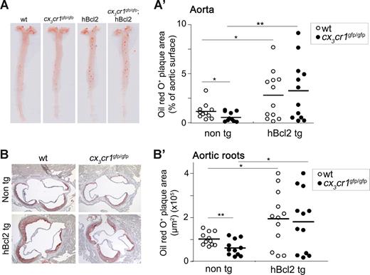 Figure 6. Enforced cell survival promotes atherogenesis in the absence of CX3CR1. Quantitative analysis of atherosclerotic lesion area in apoe−/− recipients of wt (○) and cx3cr1gfp/gfp (●) BM cells, either from hMRP8bcl2-transgenic (hBcl2 tg) or nontransgenic (non tg) donors. Mice were subjected to high-fat diet for 12 weeks, after which atherosclerotic plaques were analyzed in aortic roots (A,A') and en face prepared aortas (B,B′) by Oil Red O staining. Panels A′ and B′ show a summary of Oil Red O+ plaque area for each group, a representative of which is shown in panels A and B, respectively; n = 12, representative of 2 independent experiments. *P < .05, **P < .01 (Student t test).