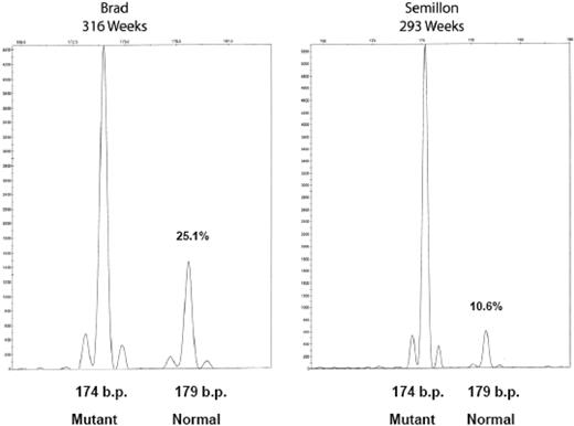 Figure 3. Vector persistence in hemophilia B dogs after liver-directed gene therapy. Hepatic biopsies, DNA isolation, FIX PCR, and microcapillary electrophoresis were as described. The fragment at 174 bp is the endogenous mutant FIX amplicon, and the fragment at 179 bp is the AAV vector-derived normal canine FIX amplicon. The relative percentage of each fragment is indicated (%) to the right of each peak. Amplification of DNA from peripheral blood and sperm DNA generated only the 174-bp fragment (not shown).