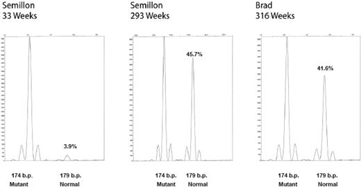 Figure 4. Accumulation of vector-derived normal FIX mRNA in hemophilia B dogs, Brad and Semillon, after liver-directed gene therapy. Hepatic biopsies, RNA isolation, cDNA synthesis, PCR, and microcapillary electrophoresis were as described.