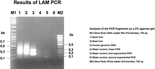 Figure 5. LAM-PCR analysis of liver biopsy DNA from Brad and Semillon. Note absence of unique bands in samples from Brad and Semillon.