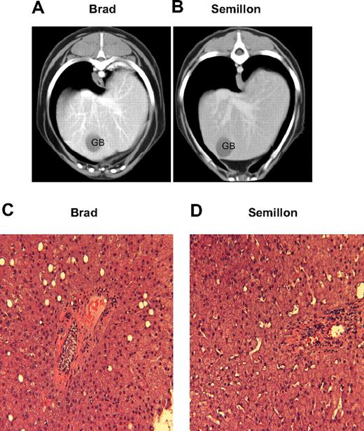 Figure 7. CT and histopathologic evaluation of hemophilia B dogs after liver-directed AAV gene therapy. After contrast sagittal CT sections of hemophilia B dog Brad (A) and hemophilia B dog Semillon (B) livers. H&E sections (×200) of liver biopsy obtained 6 years after vector administration in Brad (C) and Semillon (D). The CT evaluation, liver biopsy, and histologic processing were as described. GB indicates gall bladder.