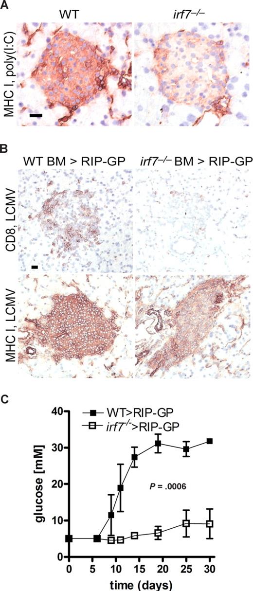 Figure 5. Hematopoietic cell–derived interferon influenced autoimmune diabetes. (A) WT and irf7−/− mice were treated with 500 μg poly(I:C) intravenously. After 24 hours, MHC I expression was analyzed in the pancreas. One of 3 representative stainings is shown. (B) BM chimeras (WT-BM > RIP-GP, irf7−/−-BM > RIP-GP) were infected with 200 PFU LCMV-WE. On day 8, pancreatic β-islets were analyzed for expression of MHC I and infiltration of CD8+ T cells. One of 3 representative stainings is shown. (C) BM chimeras (WT-BM > RIP-GP, irf7−/−-BM > RIP-GP) were infected with 200 PFU LCMV-WE. Blood glucose levels were analyzed in the blood (n = 4-5).