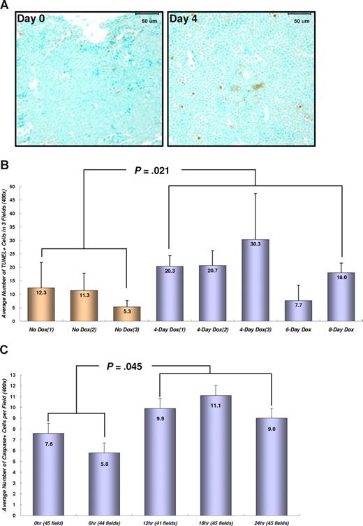 Figure 4. Conditional repression of NRASG12V expression induces apoptosis in the BM and circulating leukemia cells. (A) Apoptotic cell staining in the sternal BM with TUNEL method and Methyl Green as a counterstaining. Four days after Dox treatment, the number of apoptotic (brown) cells in the BM are increased in SCID mice transplanted with TRM-transgenic AML cells. Bars represent 50 μm. (B) Numerical comparison of apoptotic cells in BM. The average numbers of TUNEL-stained (TUNEL +) cells are shown with the standard deviation bars. The results indicate that conditional repression of NRASG12V expression significantly increases apoptotic death rates in the BM cells (P = .021). Apoptotic cell number is the average of stained cells in 3 fields. (C) Cleaved caspase-3 staining in peripheral WBCs. Apoptosis in peripheral bloods is observed 12 to 24 hours after Dox treatment. The number of apoptotic cells 12 to 24 hours is significantly increased in comparison with that of 0 to 6 hours (P = .045). The average number of apoptotic, cleaved caspase-3 positive cells was calculated by counting the stained cells in 41-45 fields at ×400 magnification. The narrow bars indicate the standard errors.