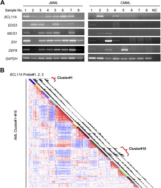 Figure 5. BCL11A expression in human leukemia. (A) BCL11A expression in human chronic myelomonocytic leukemia and juvenile myelomonocytic leukemia was detected by RT-PCR. NC indicates water in place of cDNA as template for PCR. GAPDH was used as a loading control. The JMML samples are found to carry mutations in KRAS (no. 1) or PTPN11 (nos. 2-7), or wild type for both genes (no. 8). (B) Gene expression profiling in a large cohort of human acute myelogenous leukemia. Results using a set of 3 probes for BCL11A are displayed. Probe nos. 1, 2, and 3 indicate probe sets, 210347_s_at, 219497_s_at, and 219498_s_at, respectively. Clusters of AML showing increased level of BCL11A are noted (clusters 1 and 10).
