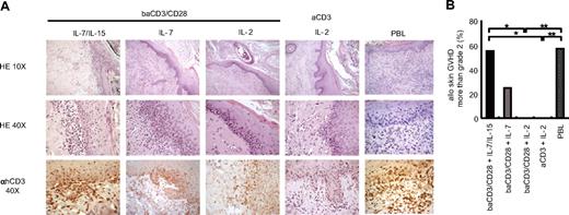 Figure 5. Central memory gene-modified lymphocytes cultured with IL-7/IL-15 are highly alloreactive. NOD/Scid mice that received a transplant of human skin, and were conditioned with anti-NK antibodies and sublethal irradiation were infused intravenously with TK+ lymphocytes or PBLs. (A) Two to 3 weeks after infusion, transplanted human skins were excised from killed mice and analyzed after staining with hematoxylin and eosin (×10 top low, ×40 middle low). Samples were simultaneously analyzed by immunohistochemistry after counterstaining with monoclonal anti-hCD3 antibodies and peroxidase-conjugated second-step reagent (×40 bottom low). Sections from representative animals of 7 independent experiments are shown. (B) Pathological grading of transplanted human skin was performed on the basis of criteria currently used for pathological diagnosis of skin GVHD in patients who underwent transplantation. Frequency of severe skin GVHD (more than grade 2) in 7 independent experiments with 9 independent T-cell donors is shown; baCD3/CD28+ IL-7/IL-15 (■, n = 9), baCD3/CD28+ IL-7 (, n = 4), baCD3/CD28+ IL-2 (, n = 7), aCD3+ IL-2 (□, n = 5), or PBLs (, n = 7). *P < .05; **P < .01.