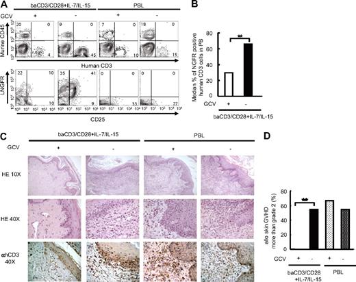 Figure 6. GCV administration controls GvHD-induced by TCM suicide gene–modified human lymphocytes. NOD/Scid mice received a transplant of human skin, and were conditioned with anti-NK antibodies and sublethal irradiation prior to the intravenous infusion of baCD3/CD28+ IL-7/IL-15 TK+ lymphocytes or PBLs. Three to 6 days after injection, mice received a transplant of a 5 mg GCV or PBS-filled mini-osmotic pump. (A) After 7 days of treatment with or without GCV, circulating cells were analyzed by flow cytometry after staining with antihuman CD3 (x-axis in top panel), antimurine CD45 (y-axis in top panel), antihuman CD25 (x-axis in bottom panel), and antihuman LNGFR (y-axis in bottom panel) antibodies. Results from 1 representative of 3 independent experiments are shown. (B) At day 7 of treatment, the percentage of circulating TK+ lymphocytes in mice infused with baCD3/CD28+ IL-7/IL-15 was measured by flow cytometry. Median results of 3 independent experiments with 8 independent T-cell donors are shown. baCD3/CD28+ IL-7/IL-15 TK+ lymphocytes from mice treated with GCV (□, n = 4); baCD3/CD28+ IL-7/IL-15 TK+ lymphocytes from mice treated without GCV (■, n = 9). **P < .01. (C) At day 7 of treatment, transplanted human skin was excised from killed mice and analyzed by histopathology after staining with hematoxylin and eosin (×10 top low, ×40 middle low). Samples were simultaneously analyzed by immunohistochemistry after counterstaining with monoclonal anti-hCD3 antibodies and peroxidase-conjugated second-step reagent (×40 bottom low). Sections from 1 representative of 3 independent experiments are shown. (D) Pathological grading of transplanted human skin was performed on the basis of criteria currently used for pathological diagnosis of skin GVHD in patients who underwent transplantation. Frequency of severe skin GVHD (more than grade 2) in animals infused with baCD3/CD28+ IL-7/IL-15 TK+ lymphocytes or PBLs, and treated with or without GCV of 3 independent experiments with 8 independent T-cell donors are shown; baCD3/CD28+ IL-7/IL-15 TK+ lymphocytes with GCV treatment (□, n = 9), baCD3/CD28+ IL-7/IL-15 TK+ lymphocytes without GCV treatment (■, n = 11), PBLs with GCV treatment (, n = 3), and PBLs without GCV treatment (, n = 11). **P < .01.