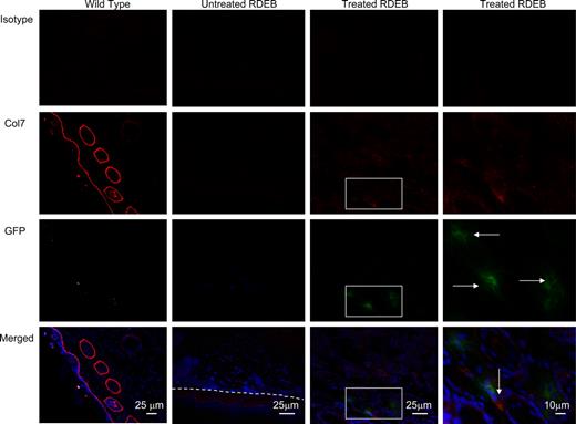 Figure 2. Col7 protein is expressed in the skin of treated Col7a1−/− animals. Representative images of footpad skin of wild-type control (first column), untreated RDEB (second column; dashed line indicates dermal-epidermal junction), and CD150+CD48− BM-treated RDEB (third column and fourth—magnified view—column) are shown. Isotype control (viewed in red fluorescence channel; top row); anti-col7 antibody (red, second row, tight linear band at the skin basement membrane zone in the wild type in the leftmost column, and positive col7a staining in the treated RDEB in the rightmost column); anti-GFP antibody (green, third row, GFP-positive cells are indicated with horizontal arrows); and merged images with blue DAPI nuclear stain (bottom row, col7 indicated with vertical arrows). Merged images demonstrate the colocalization of GFP+ donor cells and collagen type VII in the skin 10 weeks after CD150+CD48− BM infusion.