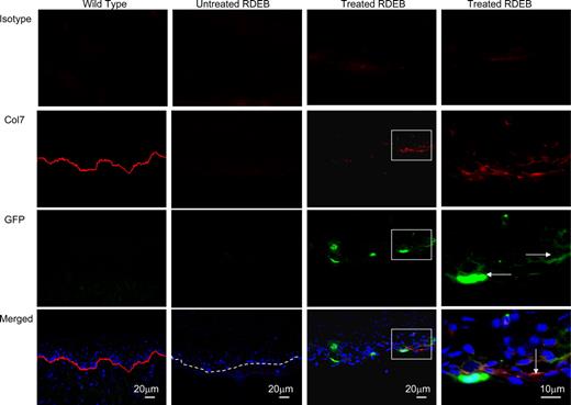Figure 4. Col7 protein is expressed in the oral cavity of treated Col7a1−/− animals. Representative images of tongue sections of wild-type control (first column), untreated RDEB (second column; dashed line indicates dermal-epidermal junction), and CD150+CD48− BM-treated RDEB (third column and fourth—magnified view—column) are shown. Isotype control (viewed in red fluorescence channel; top row); anti-col7 antibody (red, second row, tight linear band at the skin basement membrane zone in the wild type in the leftmost column, and discontinuous, yet linear, signal in the treated RDEB in the rightmost column); anti-GFP antibody (green, third row, GFP-positive cells are indicated with horizontal arrows); and merged images with blue DAPI nuclear stain (bottom row, col7 indicated with the vertical arrow). Merged images demonstrate the colocalization of GFP+ donor cells and collagen type VII in the tongue 10 weeks after CD150+CD48− BM infusion.