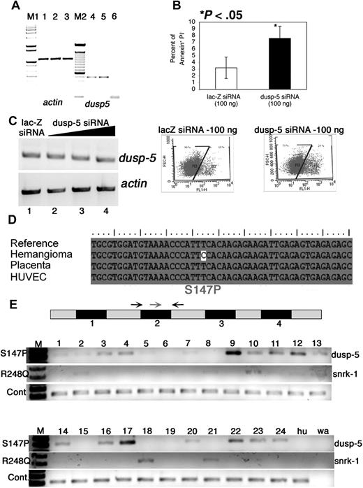 Figure 4. Dusp-5 knockdown in vitro and mutation analysis of vascular anomaly patient samples. (A) RT-PCR for actin (lanes 1-3) and dusp-5 (lanes 4-6) transcripts from UI (lanes 1 and 4), lac-Z siRNA (lanes 2 and 5), and dusp-5 siRNA-transfected (lanes 3 and 6) ECs. M1 indicates 1-kb DNA ladder marker; M2, 100-bp DNA ladder marker. (B) Percentage of apoptotic HUVECs (annexin V+ and PI−) 8 hours after transfection with 100 ng each of lac-Z and dusp-5 siRNA. The data are compiled from 4 independent experiments, and the error bars represent SEM. The dot plots indicating the gates and the percentage of annexin V–fluorescein isothiocyanate+ cells in lac-Z and dusp-5 siRNA samples. *P < .05 between sample groups. (C) RT-PCR for dusp-5 and actin transcripts from hemangioma templates. The black triangle indicates increasing concentrations of dusp-5 siRNA (lane 2, 100 ng; lane 3, 250 ng; lane 4, 500 ng) transfected into ECs, lacZ siRNA (lane 1, 500 ng). No change in dusp-5 transcript levels is noted across samples. (D) Mutation in the dusp-5 coding sequence identified only in the hemangioma sample and not from HUVEC or placenta tissue compared with the sequence of NCBI Gene Id 1847. (E) Exon-intron structure of dusp-5 in the genome. The numbers below the black box indicate exons. The gray boxes represent untranslated or intron sequences. Arrows indicate primers used for genomic PCR amplification. The red arrow indicates the mutated forward primer in exon 2; black arrow, the normal forward primer. The S147P PCR gel shows amplification resulting from the dusp-5 mutation specific red primer and the dusp-5 black reverse primer. The R248Q gel shows amplification resulting from the snrk-1 mutation-specific primer and the snrk-1 reverse primer. The wild-type (WT) gel shows amplification resulting from the dusp-5 normal forward and reverse primers. The Hu lane contains DNA from HUVEC cells, and the wa lane contains a water control with no genomic DNA in the PCR.