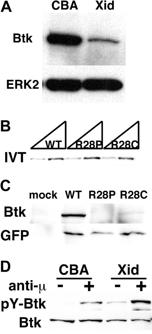 Figure 1. Xid mutation affects the stability of Btk protein. (A) Expression levels of Btk protein in Xid splenic B cells. The whole-cell lysates of splenic resting B lymphocytes obtained from control CBA/J (CBA) or Xid (Xid) mice were subjected to immunoblot analysis with an anti-Btk mAb (43-3B). The membrane was reblotted with anti-ERK2. Data are representative of 3 independent experiments with similar results. (B) The expression vector (0.5 μg and 1.0 μg per reaction, respectively) for either human wild-type Btk (WT) or XLA-derived mutants (R28P and R28C) was in vitro transcribed and translated in the presence of Transcend tRNA (Promega). The amounts of biotinylated Btk proteins were evaluated with streptavidin-HRP. (C) Jurkat T lymphocytes were transiently transfected with the expression vector for either human wild-type Btk (WT) or XLA-derived mutants (R28P and R28C), which contains EGFP downstream of an IRES. Whole-cell lysates were subjected to immunoblot with an anti-Btk antibody (top panel), followed by reblot with an anti-GFP antibody (bottom panel). (D) In vivo activation of Btk protein with Xid mutation. Splenic B cells obtained from 2 control CBA or 20 Xid mice were stimulated with or without 20 μg/mL anti-IgM F(ab′)2 (anti-μ) at 37°C for 3 minutes. Btk was then immunoprecipitated with an anti-Btk antibody, followed by immunoblot analysis with 4G10 (pY-Btk). The membrane was reblotted with 43-3B (Btk). Data in panels B through D are representative of 2 independent experiments with similar results.