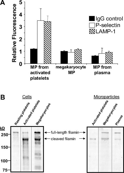 Figure 5. Megakaryocyte-derived microparticles resemble plasma-derived microparticles with regard to surface markers and expression of full-length filamin A. (A) Microparticles were isolated from mouse platelets incubated with thrombin and collagen, cultured mouse megakaryocytes, or platelet-free plasma. Microparticles were subsequently labeled with nonimmune IgG, anti-CD62P antibody, or anti–LAMP-1 antibody as indicated. Error bars indicate the standard deviation of 4 independent assays. (B) Filamin A was assayed by immunoblot analysis in resting mouse platelets, mouse platelets exposed to thrombin plus collagen, and cultured megakaryocytes. Filamin A was also assayed by immunoblot analysis in microparticles isolated from activated platelets, cultured mouse megakaryocytes, or platelet-free mouse plasma. Full-length filamin A is found in megakaryocyte-derived microparticles and circulating microparticles, but not microparticles from activated platelets.