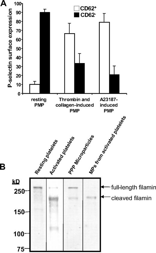 Figure 6. Analysis of CD41+ microparticles from human plasma demonstrates that the majority are CD62P− and contain full-length filamin A. (A) Microparticles were isolated from human plasma, platelets activated with thrombin and collagen, or platelets activated by Ca2+-ionophore A23187 and analyzed for CD62P expression by flow cytometry. The percentage of CD62P+ (□) and CD62P− (■) microparticles is indicated. Error bars indicate the standard deviation of 4 independent assays. (B) Filamin A was assayed by immunoblot analysis in resting human platelets, human platelets exposed to thrombin and collagen, microparticles isolated from platelet-free plasma, or microparticles isolated from activated platelets.