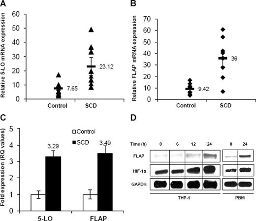 Figure 1. 5-LO and FLAP mRNA expression in MNC, PBM, and THP-1. (A,B) qRT-PCR analysis of mRNA in MNC isolated from SCD subjects at steady state (n = 9) and healthy controls (n = 9). Each data point represents ΔCt values of 5-LO and FLAP expression from individual subjects. Mean values are represented as black bars. Error bars represent SEM. (C) ΔΔCt (RQ) values show fold expression of 5-LO and FLAP mRNA in SCD compared with healthy controls. (D) RPA analysis of FLAP, HIF-1α, and GAPDH in PlGF-treated THP-1 cells and PBM for the indicated time periods. Data are representative of 3 independent experiments. Where indicated, the vertical lines show repositioned gel lanes.