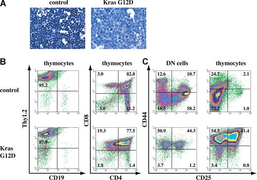 Figure 1. A fraction of recipient mice that received transplants of total bone marrow cells expressing oncogenic Kras from its endogenous locus developed thymic T-cell lymphoblastic lymphoma. (A) Representative histopathology (original magnifications of camera lenses used to take the picture listed in parentheses) from thymus (× 100) stained with hematoxylin and eosin (H&E) showed development of thymic lymphoma in mice that received transplants of bone marrow cells expressing oncogenic Kras G12D from its endogenous locus. (B,C) Flow cytometry analysis of thymocytes or purified DN cells isolated from the thymus of control mice or mice that received transplants of bone marrow cells expressing oncogenic Kras. These density plots were gated on live nucleated cells based on forward scatter and propidium iodide staining profiles. More than 98% of the cells analyzed here are donor-derived as judged by their CD45.2 expression. Representative data are shown. The percentages of cells in quadrants of interest are indicated.