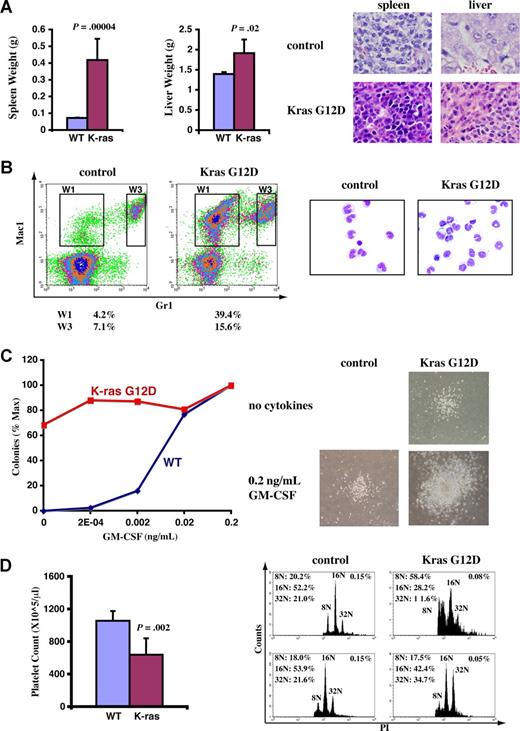 Figure 3. A fraction of recipient mice that received transplants of total bone marrow cells expressing oncogenic Kras from its endogenous locus developed JMML-like phenotypes. Diseased and control mice were killed approximately 3 months after transplantation when diseased mice became moribund. (A) Diseased mice showed enlarged spleen and liver. Representative histologic H&E sections from spleen (×60) and liver (×60) showed an extensive infiltration of myelomonocytic cells in the splenic and hepatic parenchymas of the recipient mice that received transplants of bone marrow cells expressing oncogenic Kras G12D (original magnifications of camera lenses used to take the pictures listed in parentheses). (B) Flow cytometric analysis of peripheral blood samples from control mice or mice that received transplants of bone marrow cells expressing oncogenic Kras. These density plots were gated on donor-derived, live nucleated cells based on forward scatter, propidium iodide staining, and CD45.2 expression profiles. Representative data are shown. The percentages of cells in regions of interest are indicated. W1 cells were sorted, centrifuged on slides, and stained with May-Grunwald-Giemsa stains to confirm their monocyte identity (right). (C) A total of 105 bone marrow cells were plated in duplicate in semisolid medium with or without GM-CSF. The data were presented as percentages of the maximum number of colonies formed in culture with 0.2 ng/mL GM-CSF. The experiments were repeated independently using cells from at least 3 mice, and representative results obtained from one mouse are shown here. Photomicrographs (original magnification ×20) show wild-type and mutant Kras G12D myeloid progenitor colonies grown in different concentrations of GM-CSF. (D) Platelet counts in peripheral blood and bone marrow (BM) megakaryocyte analysis. CD41+ megakaryocytes from control BM and Kras G12D BM were analyzed for DNA content. Only mature megakaryocytes with 8N and greater ploidy are shown. The percentages of mature megakaryocytes are indicated. (A,D) Student t test was performed. The data are presented as averages plus SD.