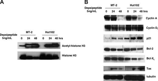 Figure 2. Depsipeptide treatment induced accumulation of histone acetylation and altered the expression of cyclin A, p21, Bcl-2, and Bcl-XL in HTLV-I–infected cell lines. (A) Accumulation of histone H3 acetylation after depsipetide treatment. MT-2 and Hut102 cells were treated with 5 ng/mL of depsipeptide for 24 hours and 48 hours. Total cell lysate (50 μg/lane) was separated on sodium dodecyl sulfate-polyacrylamide gels and transferred to the membrane. Acetyl-histone H3 or histone H3 levels were detected by Western blot with specific antibodies. (B) Effect of depsipeptide on the expression of cyclin A, cyclin D, p21, Bcl-2, Bcl-XL, and viral protein Tax. Cell lines were treated with 5 ng/mL of depsipeptide for 24 hours and 48 hours, and then total cellular protein was extracted and Western blot analysis was performed.