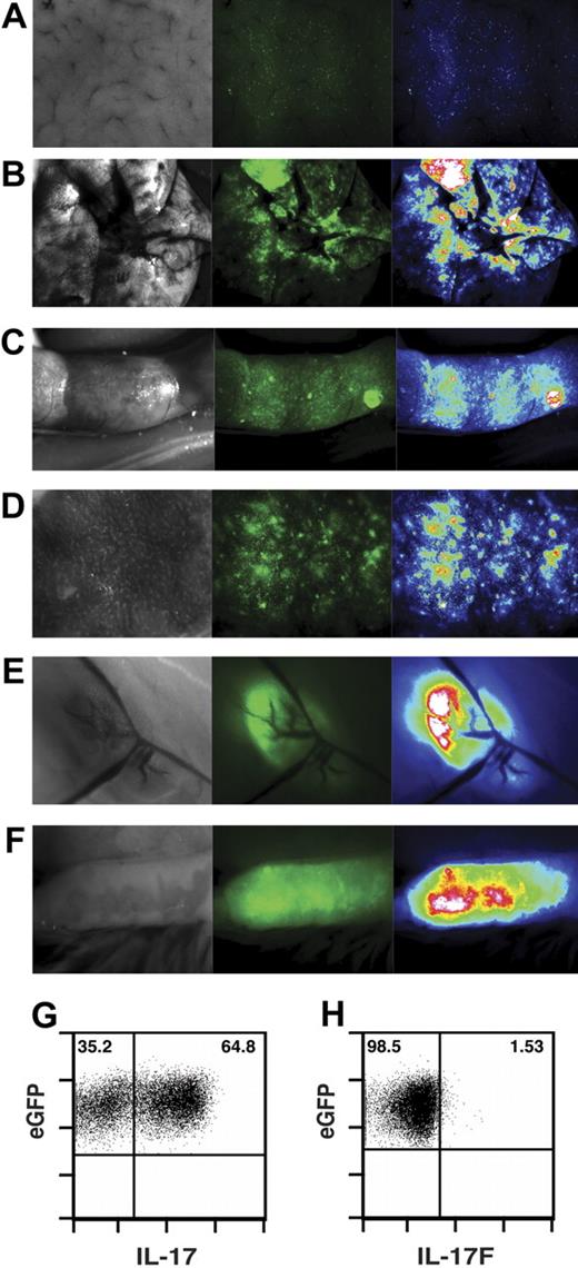 Figure 5. In vitro–differentiated TH17 cells traffic to GVHD target organs and secondary lymphoid organs. Naive CD4+ T cells from eGFP+ mice were differentiated into TH17 cells as in Figure 1. TH17 cells (1.35 × 106) were transferred with T cell–depleted bone marrow cells into lethally irradiated B6D2 recipients. Seven days after transfer, animals were anesthetized with avertin, and organs were imaged with a Zeiss SteREO Lumar.V12 microscope with eGFP bandpass filter. Brightfield images (left) and GFP images (middle) were taken for each organ. GFP intensities (right) were determined by software analysis: liver (A), lung (B), colon (C), spleen (D), inguinal lymph node (E), and mesenteric lymph node (F). eGFP+ TH17 cells were transferred into irradiated B6D2 recipients. Eight days after transplantation, lymphocytes were extracted from the lung and stimulated as in Figure 1 followed by intracellular cytokine staining for IL-17A (G) and IL-17F (H). Plots derived from eGFP+ gate. We verified that the eGFP signal documented was not due to background autofluorescence by transfer of non–GFP-expressing T cells and imaging of GVHD target organs and lymphoid tissues as described previously (Figure S2). Original magnification liver = ×40, lung = ×25, colon = ×20, spleen = ×40, ILN = ×45, MLN = ×45.