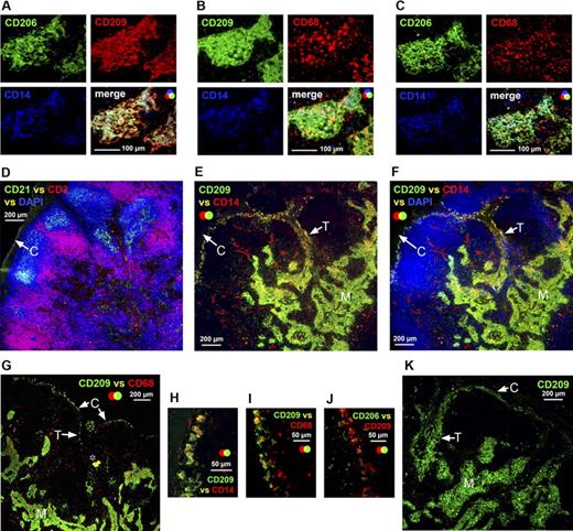 Figure 3. APCs expressing a similar phenotype to the APCs in medullary cords lined the capsule and trabeculae in the human axillary lymph node. Immunohistochemistry demonstrated that the APCs packed into the medullary cords expressed CD209; the majority of these APCs also expressed CD206, CD14, and CD68 (A-C). Anatomical definition was obtained by staining lymph node sections with antibodies detecting CD3 and CD21 to identify the T lymphocyte–rich paracortex and follicles, respectively (D). A sequential section probed with antibodies detecting CD209 and CD14 demonstrated that a population expressing these markers was scattered along the basement membranes of the capsule and trabeculae (E,F). This subcapsular APC population was consistently observed in all axillary lymph nodes (H) and coexpressed CD68 (G,I); a few of these cells also expressed CD206 (J). In one axillary lymph node, an unusually large number of cells expressing CD209 were detected beneath the capsule and along the trabeculae (K). Panels A to C were acquired from the same area on sequential sections as were panels D to F. M indicates medullary cords; white arrows identify the capsule (C) and trabeculae (T) (D-G, K). *Background autofluorescence. Data are representative of 4 independent experiments.