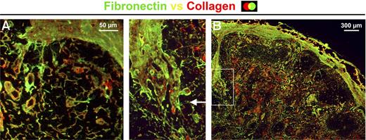 Figure 5. Conduits branch from the capsule and trabeculae and radiate into the human axillary lymph node. Immunohistochemistry illustrated that collagen fibers expressing fibronectin branched from the outer capsule of the lymph node and integrated with the fibroreticular cell network in the lymph node (A). Similarly, trabeculae that were constructed of collagen fibers and expressed fibronectin radiated deep into the lymph node, branched, and merged with the conduit network (B). Data are representative of 4 independent experiments.