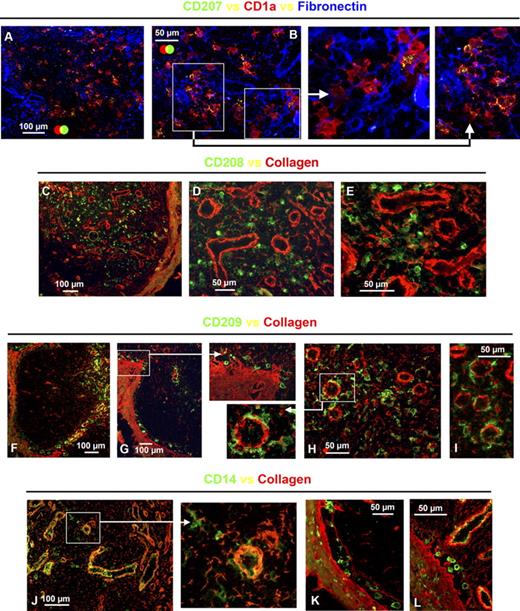 Figure 6. APCs in the human axillary lymph node associate with the fibroreticular cell network. Frozen lymph node sections were probed with antibodies to either collagen or fibronectin to map the fibroreticular cell network. Multicolor immunohistochemistry illustrated that the majority of CD1a+CD207−, CD1a+CD207+ (A,B), and CD208+ APCs (C-E) were either in intimate contact with or tethered to fibroreticular cell structures. Most APCs expressing CD209 (F-I) and CD14 (J-L) were also in close contact with fibroreticular cell structures. Interestingly, CD209+ and CD14+ APCs tended to cluster around ring-like structures resembling high endothelial venules (F-J). Just beneath the outer capsule, there was a narrow void lacking collagen fibers; the CD209+ and CD14+ APCs distributed along the basement membrane of the capsule were tethered to the collagen fibers at either side of this subcapsular space, possibly sinus (F,G,K,L). Data are representative of 3 independent experiments.