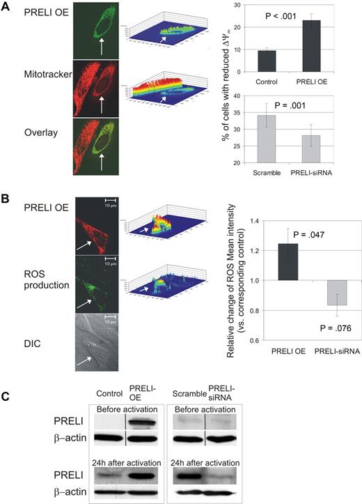 Figure 2. PRELI localizes in mitochondria, alters the Δψm, and induces mitochondrial ROS production. (A) PRELI localizes in mitochondria and reduces Δψm. HeLa cells were stained for pFlag-PRELI (transfected cell indicated by white arrow). Mitochondria were visualized with MitotrackerRed CMXRos. Intensity profiles (middle panel) visualize FITC (PRELI overexpression) and Mitotracker fluorescence intensities in these cells. CD4+ cells (right panel) were nucleofected with pIRES-H2Kk (control) or PRELI overexpression vector (black bars) and subsequently sorted. Cells were also nucleofected with scramble or PRELI-siRNAs (). Subsequently, the cells were activated (with α-CD3 0.1 or 0.5 μg/well and α-CD28) for 24 hours, stained with Mitoprobe DilC15 and analyzed by flow cytometry. Two separate cell populations with high and low Mitoprobe DilC15 intensities seen in the flow cytometric analysis depict cells with active and reduced membrane potentials, respectively (histograms not shown). Thus, the percentage of cells with reduced membrane potential stands for the proportion of cells with low Mitoprobe DilC15 intensity in a sample. Bars represent the mean values plus or minus SEM of 7 independent experiments. (B) PRELI induces mitochondrial ROS production. Overexpressed pFlag-PRELI (Alexa 568, red) and mitochondrial ROS production stained with DHR123 (green). CD4+ cells (right panel), nucleofected and activated as in panel A, were stained with DHR123 and analyzed by flow cytometry. Bars represent the average fold changes plus or minus SEM of ROS intensity in PRELI overexpression or PRELI-siRNA samples compared with the corresponding control sample (pIRES-H2Kk or scramble). The values of the control samples were set as 1. Overexpression and siRNA data are obtained from 7 and 4 independent experiments, respectively. (A,B) Δψm and ROS were measured from living cell populations according to forward scatter/side scatter (FSC/SSC) plots (overexpression experiments) or total cell population (siRNA experiments). Statistical significances were calculated using the 2-tailed paired t test. (C) Representative levels of PRELI protein in overexpression and knockdown experiments. In overexpression experiments the peripheral blood CD4+ cells, transfected with pIRES-H2Kk-PRELI or pIRES-H2Kk control vector, were enriched 16 hours after the nucleofection and subsequently activated for 24 hours. In PRELI knockdown experiments, the cells nucleofected with scrambled- or PRELI-siRNA oligos were incubated for approximately 24 hours and subsequently activated for 24 hours. Samples were harvested for Western blotting before (in overexpression experiments after the enrichment) and after the activation. Vertical lines have been inserted to indicate a repositioned gel lane. OE indicates overexpression.