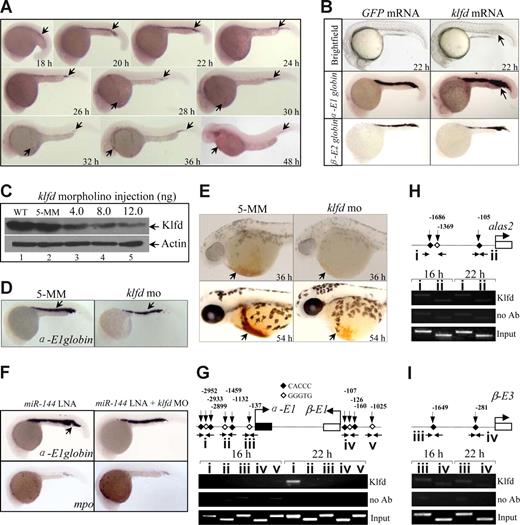 Figure 5. Klfd selectively transactivates α-E1 globin promoter. (A) WISH analysis of klfd mRNAs at the indicated stages. The klfd is first detected in the ICM of 18 hpf embryos. Embryos are lateral views with the head to the left. (B) Forced expression of klfd mRNAs (20 pg) increases α-E1 globin expression at 24 hpf (arrows). (C) Knockdown of Klfd protein by morpholino in vivo. Western blot analysis of embryos injected with 5-MM control (Ctrl) or klfd-specific morpholino oligonucleotides at the indicated doses. The proteins extract from 20 embryos at 22 hpf were loaded into each lane. WT indicates wild-type. Actin was used as a loading control. (D) Knockdown of Klfd reduces α-E1 globin expression at 22 hpf (arrows). (E) Decreased hemoglobin staining by O-dianisidine at 36 and 54 hpf (arrows). (F) Knockdown of Klfd is able to significantly rescue the overproduction and ectopic expression of α-E1 globin induced by miR-144 deficiency (arrow). The mpo expression was not affected. (G-I) The Klfd selectively binds to the distal CACCC elements of α-E1 gene promoter. E-ChiP analysis of chromatin extracted from 16 and 22 hpf embryos. PCR was performed using the primers located to the indicated promoter regions for α-E1 (G, regions I-III), β-E1 (G, regions IV and V), alas2 (H, regions I and II), and β-E3 (I, regions III and IV). The Klfd was significantly enriched at the CACCC boxes (region I) of α-E1 globin promoter at 22 hpf (g) but not at 16 hpf. The results were repeated 4 times with separate batches of chromatin preparations.