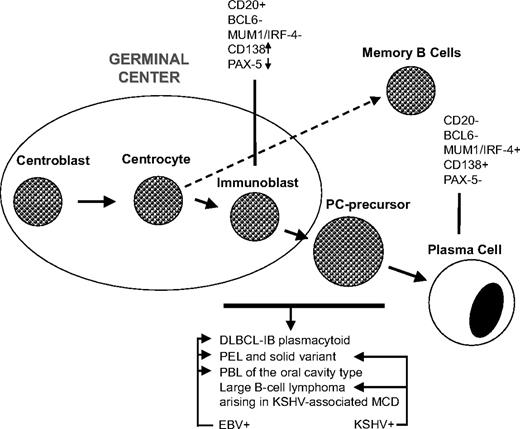 Figure 6. Lymphomas specifically arising in HIV-induced immunosuppression. Stage of differentiation and the putative cell of origin. Lymphoma histotypes occurring specifically in HIV-infected patients exhibit a common normal cellular counterpart that might be defined as plasmablast. The figure defines the following main subgroups of lymphoma with plasmablastic differentiation: (1) HIV-associated lymphoma showing IB morphology with plasmacytoid differentiation; these lymphomas can be either systemic or primary central nervous system lymphomas; (2) tumors classified as PELs and their extracavitary variant exhibiting infection by both KSHV and EBV; (3) tumors classified as PBL of the oral cavity type, showing a monomorphic population of immunoblasts with no or minimal plasmacytic differentiation; most patients are HIV infected and tumor cells are EBV positive but KSHV negative; most cases present in the oral mucosa, whereas a significant number of cases present in other extranodal or nodal site; and (4) large B-cell lymphoma arising in KSHV-associated multicentric Castleman disease (MCD) consisting of KSHV-infected plasmablasts, which show evidence of light chain restriction and may represent a monotypic cell population, found in small clusters surrounding or replacing follicles, in MCD. Therefore, important features to subclassify these neoplasms include the stage of differentiation of the putative cell of origin and association with viruses. Lymphomas with plasmablastic differentiation are a heterogeneous group of neoplasms with different clinicopathological characteristics and different associations with specific viruses. DLBCL-IB indicates diffuse large B-cell lymphoma-immunoblastic; EBV, Epstein-Barr virus; KSHV, Kaposi sarcomaherpesvirus; MCD, multicentric Castleman disease; PBL, plasmablastic lymphoma; PC, plasma cell; and PEL, primary effusion lymphoma.