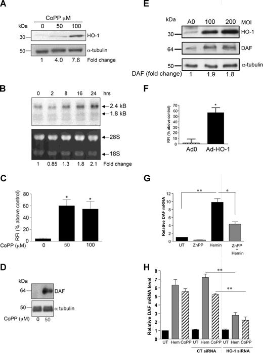 Figure 2. CoPPIX induces DAF expression on vascular ECs. (A) HUVECs were treated for 24 hours with CoPPIX (up to 100 μM), and HO-1 expression was detected by immunoblotting. (B). HUVECs were treated for up to 24 hours with CoPPIX (50 μM). Total RNA was isolated; Northern blots prepared and probed for DAF mRNA. The fold change in DAF mRNA was calculated after densitometric scanning, normalized with respect to the ethidium bromide–stained 28S band. (C,D) HUVECs were cultured for 24 hours in the presence of CoPPIX or vehicle alone, and DAF expression was measured by (C) flow cytometry with results expressed as percentage increase in RFI above control ECs, treated with plain culture medium alone (mean ± SEM; n = 3 experiments) and (D) by immunoblotting. (E) HUVECs were infected with a HO-1 recombinant adenovirus (Adv–HO-1) at an MOI of up to 200 virus particles per cell or an empty vector control adenovirus (Ad0; MOI 200). ECs were lysed 24 hours after infection, and expression of HO-1, DAF, and α-tubulin was analyzed by immunoblotting. Relative levels of DAF protein expression were quantified using image analysis densitometry and expressed as the fold change above that in Ad0-infected ECs. (F) HUVECs were infected with Adv–HO-1 or Ad0 (MOI 200), and DAF expression was measured by flow cytometry 24 hours after infection, with results expressed as percentage increase in RFI above noninfected control ECs (mean ± SEM; n = 3 experiments). (G) HUVECs were treated for 8 hours with hemin (0.2 μM) in the presence or absence of ZnPPIX (15 μM) or vehicle alone (UT). DAF mRNA levels were quantified by real-time PCR, and data are mean plus or minus SEM (n =2 experiments) relative to untreated ECs. (H) HUVECs were left untreated (UT) or transfected with control siRNA (Ctrl) or HO-1 siRNA before treatment with hemin (Hem; 0.2 μM), CoPP (50 μM), or vehicle and DAF mRNA quantified by real-time PCR as above. *P < .05; **P < .01.