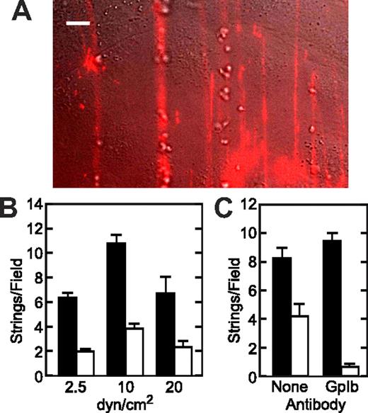 Figure 3. A subset of VWF strings binds platelets. Perfusion assays were performed in the presence of 100 μM histamine, 108/mL fixed platelets, and fluorescent VWF polyclonal antibody. (A) A representative image of VWF strings and platelet strings for perfusion assay conducted at 2.5 dyne/cm2. Bar represents 10 μm. (B) Total fluorescent VWF strings (■) and platelet-decorated VWF strings (□) formed under a fluid shear stress of 2.5, 10, and 20 dyne/cm2 are shown as the mean plus or minus SEM from 10 fields per experiment. (C) Perfusion assays were performed at a shear stress of 2.5 dyne/cm2 in the presence or absence of 20 μg/mL antiplatelet GPIbα antibody 6D1. Total fluorescent VWF strings (■) and platelet-decorated VWF strings (□) are shown as mean plus or minus SEM from 10 fields per experiment. Each experiment was repeated at least twice.