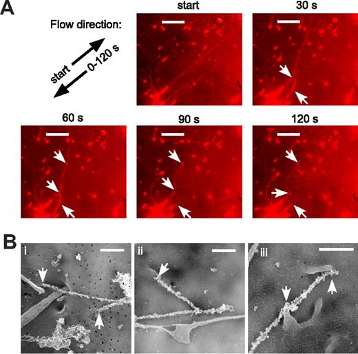 Figure 4. VWF strings attach to HUVECs by discrete adhesion sites. (A) HUVECs were stimulated with histamine and exposed to laminar flow at a shear stress of 2.5 dyne/cm2. After 5 minutes, flow direction was reversed and images were captured every 30 seconds. indicate the initial flow direction (start) and the reversed flow direction (0-120 s). indicate anchorage sites for VWF strings. Bars represent 20 μm. (B) Electron micrographs of immunogold-labeled VWF strings. Samples were prepared as described in “Immunoelectron microscopy.” Arrows indicate cell extrusions in direct contact with VWF strings. Bars represent 500 nm.