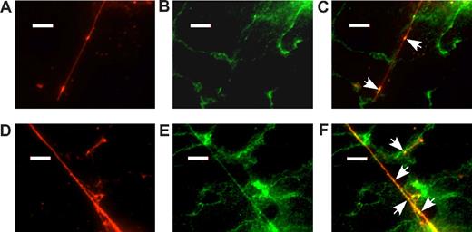 Figure 7. Integrin αv decorates acutely secreted VWF strings. Confluent HUVECs in a flow chamber were stimulated with 100 μM histamine at 2.5 dyne/cm2 shear stress for 5 minutes, fixed, and incubated with anti-VWF and anti-integrin αvβ3 antibodies as described in “Immunofluorescence microscopy.” Panels show immunofluorescence for VWF (A,D) and integrin αvβ3 (B,E) with corresponding fluorescent antibodies. Merged images are shown in panels C and F. Arrows indicate selected examples of the colocalization of VWF and integrin αvβ3. Bars represent 10 μm.