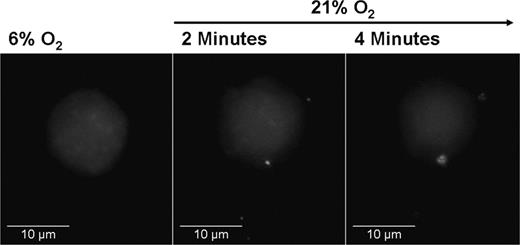 Figure 7. OCI-AML3 cell loaded with cytoplasmic quantum dots. (Left) Representative cell at 6% O2. (Middle) The same cell after 2 minutes of reoxygenation with 21% O2. Four Qdot-containing particles leaving the cell can be seen in the picture. (Right) The cell loses fluorescence, indicating loss of Qdots. (100×/1.4 NA oil.)
