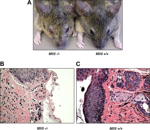 Figure 3. Mll5−/− mice are susceptible to bacterial infection. (A) Blepharitis in Mll5−/− mice. Histologic comparison of representative hematoxylin and eosin sections of (B) affected eyelids from Mll5−/− compared with (C) normal eyes from wild-type mice (original magnification ×400).