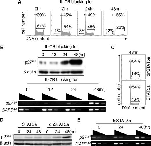 Figure 2. Constitutive activation of JAK3/STAT5 signaling inhibits p27kip1 expression in BKO84 cells. (A) Cell-cycle profiles of BKO84 cells that were cultured in medium containing αIL-7R for the indicated time period. Cells were stained with propidium iodide and analyzed by flow cytometry. Percentages of cells in subdiploid (if present), G1, and S/G2/M phases are indicated by numbers. (B) Western blot analysis of p27kip1 protein (top) and β-actin as a loading control (top middle), and semiquantitative RT-PCR analysis of p27kip1 mRNA (bottom middle) and GAPDH as a cDNA quantity control (bottom) of the same cells as in panel A. (C,D) Cell-cycle analysis (C) and Western blot analysis for p27kip1 protein (D) in BKO84 cells infected with retroviral vectors carrying either dnSTAT5a or STAT5a coupled via an IRES to rCD2. Cells expressing the rCD2 were magnetically sorted at the indicated times after infection and analyzed. (E) Semiquantitative RT-PCR analysis of p27kip1 mRNA and GAPDH mRNA (cDNA quantity control) in BKO84 cells transduced with dnSTAT5a as in panel D. All data are representative of 3 independent experiments.
