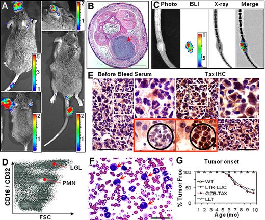Figure 2. TAX-LUC mice spontaneously develop bioluminescent tumors. (A) BLI of TAX-LUC mice with peripheral tumors on the nose, ear, foot, and tail. (B) Hematoxylin and eosin (H&E)–stained section of a bioluminescent inflammatory tail nodule (red arrow). Bar = 1 mm. (C) Coregistration of photograph, BLI, and X-ray images. (D) Fluorescence activated cell sorting (FACS) histogram of a tumor homogenate. (E) Immunohistochemistry (IHC) on sequential sections of a bioluminescent tumor (white inset) and liver involvement (red inset with black circle) stained with Tax or prebleed serum. Bar = 50 μm. (F) Wright/Giemsa-stained peripheral blood smear from an animal with advanced lymphoma. Red arrows indicate multinucleated LGL cells. (G) Rate of tumor development in TAX-LUC (n = 11) and GZB-TAX (n = 9) mice. Color scale for panels A and C is ×104 photons/s/cm2/sr.