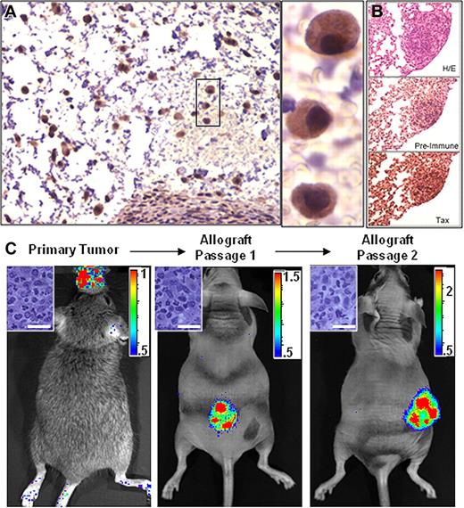 Figure 3. Bioluminescence is a property of transformed LGL cells. Homogenate from a primary bioluminescent tumor implanted into and passaged in Beige/Nude/Xid (BNX) mice. (A) Tax IHC on sections of BNX tumors. (B) IHC on sequential sections of a bioluminescent lung tumor stained with H&E, Tax serum, or pre-bleed serum. (C) BLI of tumors in BNX mice confirmed that luciferase activity transferred with the malignant cell population. Bar = 20 μm. Color scale ×104 photons/s/cm2/sr. Data shown are representative of allografts in 23 mice injected with cells from fresh or frozen primary tumor tissue.