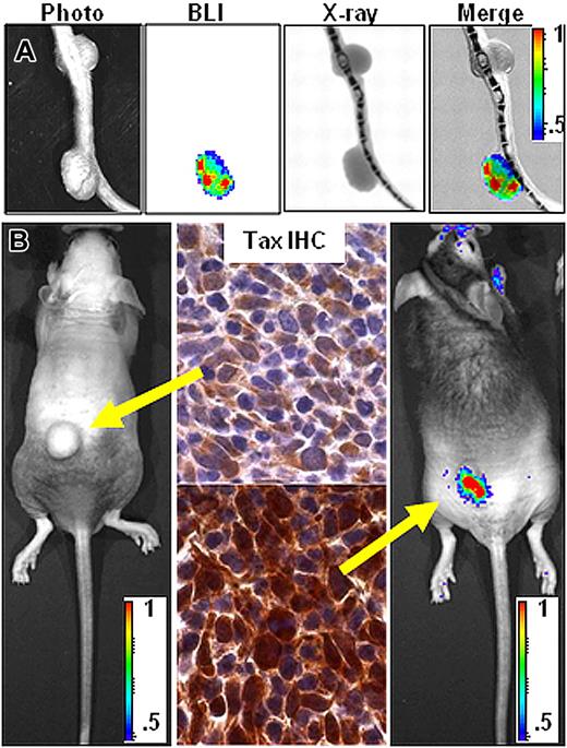 Figure 4. Bioluminescence correlates with Tax expression. (A) Coregistration of photograph, BLI, and X-ray images on tail tumors with differing bioluminescent properties. (B) Comparison of bioluminescence and TAX expression on tumors arising in 2 different BNX animals injected with homogenate from a single bioluminescent primary TAX-LUC tumor. Yellow arrows indicate correspondence between tumor BLI and TAX IHC. Color scale ×104 photons/s/cm2/sr.