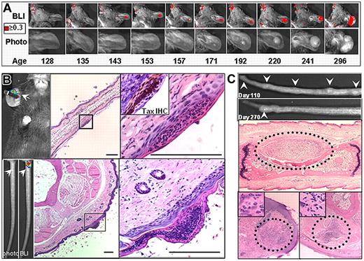 Figure 6. Bioluminescence identifies early stages in tumor development. Serial images of the development of a spontaneous ear tumor in a TAX-LUC animal. Color indicates flux is greater than or equal to 0.3 × 104 photons/s/cm2/sr. (B) Bioluminescence (white arrow) generated by D-luciferin on an otherwise unremarkable ear or tail juxtaposed to corresponding histology. H&E, bar = 100 μm. Inset is TAX IHC on a serial section. (C) Palpable nodules that develop then resolve on the tails of TAX-LUC animals. Histologic sections through the nodules consistently involve inflammatory admixture but presence of malignant LGL cells is variable.