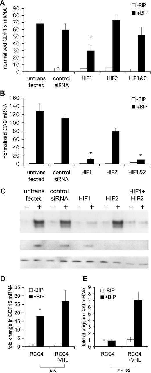 Figure 3. GDF15 induction by iron depletion is independent of HIF. HeLa cells were seeded at 2 × 105 cells/mL and transfected at 24 hours and 48 hours with 200 nM HIF-1α siRNA, HIF-2α siRNA, or a combination of both. dHIF siRNA was used as an irrelevant control siRNA. After the second transfection, cells were treated with 100 μM BIP for a further 16 hours, after which cells were harvested for mRNA and protein extraction. (A) qPCR quantification of GDF15 induction by BIP in the presence of various HIF siRNA treatments. (B) qPCR quantification of CA9 induction by BIP. (C) Western blotting for human HIF-1α and HIF-2α. Cell lysates were electrophoresed on SDS-polyaccrylamide gel, transferred onto cellulose acetate membrane, and stained with human monoclonal HIF-1α or HIF-2α antibodies. The housekeeping protein β-tubulin was stained as a loading control. (D,E) RCC4 cells stably transfected with empty vector or wild-type VHL-HA were seeded at 2 × 105 cells/mL and then cultured for 16 hours in the presence of 100 μM BIP. GDF15 and CA9 fold-induction by BIP compared with untreated cells was determined by qPCR after normalization to β-actin levels. In contrast with CA9, GDF15 was strongly induced by BIP irrespective of VHL status. *P < .05 compared with control siRNA with BIP.