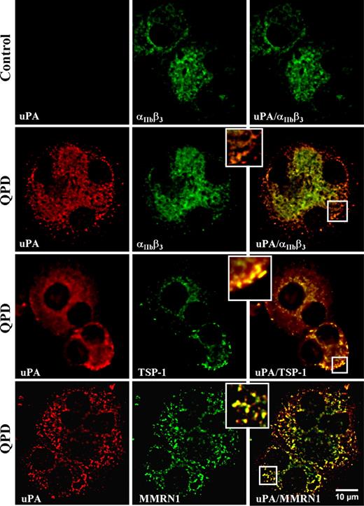 Figure 2. Intracellular distribution of uPA compared with αIIbβ3, and α-granule proteins TSP-1 and MMRN1 in day-13 QPD and control cultured megakaryocytes. Panels show deconvolved immunofluorescent images of megakaryocytes, double immunolabeled with rabbit anti-uPA (red, left panels) and mouse monoclonal antibodies to αIIbβ3, TSP-1, or MMRN1 (green, middle panels) (merged images on right). Insets show magnified images of peripheral cytoplasm. Experiments were performed as outlined in “Immunofluorescent microscopy.”