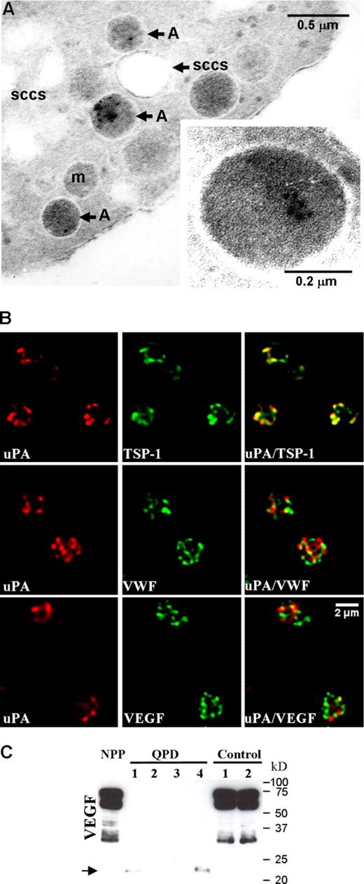 Figure 3. The uPA storage site in QPD platelets. (A) Immunogold labeling of uPA in QPD platelets, showing occasional uPA labeling in α-granules, with no significant labeling of the surface-connected canalicular system (SCCS), mitochondria (m), or plasma membrane. Inset shows a QPD platelet α-granule under higher magnification. Experiments were performed as outlined in “Immunoelectron microscopy.” (B) Deconvolved immunofluorescent images of QPD platelets, double immunolabeled with an antibody to uPA (red, left panels) and antibodies to TSP-1, VWF, or VEGF (green, middle panels) (merged images on right). Experiments were performed as outlined in “Immunofluorescent microscopy.” (C) Western blot of VEGF in pooled platelets from 20 healthy individuals (NPP), and in platelets from 4 QPD and 2 control individuals, evaluated after SDS-PAGE. Arrow indicates VEGF forms with lower mobility in QPD platelets.