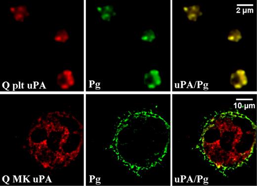 Figure 4. Distributions of plasminogen and uPA in day-13 QPD cultured megakaryocytes compared with platelets. Deconvolved immunofluorescent images of QPD platelets (Q plt) and QPD megakaryocytes (Q MK) grown with plasma. Cells were double immunolabeled with antibodies to uPA (red) and plasminogen (Pg, green; merged images at right). Experiments were performed as outlined in “Immunofluorescent microscopy.”