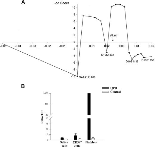Figure 1. Multipoint linkage and allelic expression analysis of PLAU in QPD. (A) Results of multipoint linkage using 4 microsatellite markers (positions are shown relative to GATA121A08). The genetic location of PLAU between markers D10S1432 and D10S1136 is indicated on the x-axis, which is the region with the highest LOD score for this analysis (+11). (B) Graph of reverse transcriptase–quantitative PCR (RT-qPCR) analyses of PLAU alleles for SNP rs4065 in different tissues and indicates the measured ratios of T/C alleles in saliva cells, CD34+ cells, and platelets in samples from 5 controls and 4 individuals with QPD. T/C ratios were significantly different for QPD compared with control samples for all tissues (P = .016).