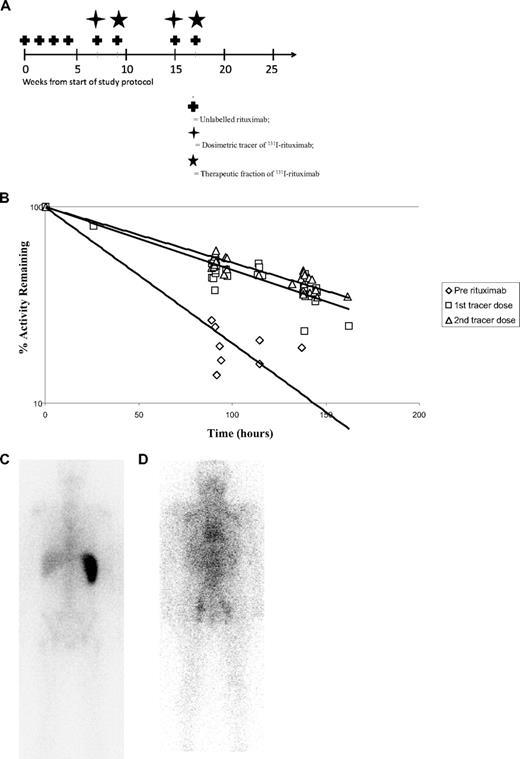 Figure 1. 131I-rituximab administration. (A) Schematic outline of treatment schedule for rituximab followed by 131I-rituximab. A total of 375 mg/m2 of unlabeled rituximab was administered weekly for 4 weeks, shown as weeks 0, 1, 2, and 3. The dosimetric tracers of 185 MBq of 131I-rituximab were delivered on weeks 7 and 15. The therapeutic fractions of 131I-rituximab were each administered 2 weeks after dosimetry, at weeks 9 and 17. Both the dosimetric tracers and the therapeutic fractions of 131I-rituximab were delivered immediately after an infusion of 100 mg/m2. The dosimetry of 5 patients was assessed with a 185-MBq dosimetric tracer dose of 131I-rituximab before receiving any rituximab. (B) The clearance of 131I-rituximab in patients before rituximab and after the first and second 131I-rituximab tracer dose. The pharmacokinetics of 131I rituximab were calculated using whole-body anterior and posterior gamma camera images obtained within 1 hour after completion of the tracer infusion dose and on days 4 and 6 after 131I-rituximab administration. For the prerituximab group, no rituximab had been administered before the dosimetric studies. For groups marked “dose 1” and “dose 2,” 4 weekly infusions of 375 mg/m2 were given according to the schedule in panel A. For the predose, a further 100 mg/m2 of unlabeled rituximab was administered as an intravenous infusion, followed 2 to 3 hours later by an infusion of 185 MBq 131I-rituximab. (C) 131I-rituximab administered without prior rituximab treatment is mostly sequestered to the spleen. Whole-body gamma camera scanning was performed after administration of 185 MBq 131I-rituximab without any prior rituximab. The radiolabeled rituximab and gamma activity is visualized within the spleen. (D) Biodistribution of 131I rituximab after 4 loading doses of rituximab. After induction therapy with 4 weekly infusions of rituximab (375 mg/m2), the 131I-rituximab no longer localizes to the spleen, and there is a more widespread biodistribution throughout the body. Tumor targeting within known pelvic lymph nodes is observed.