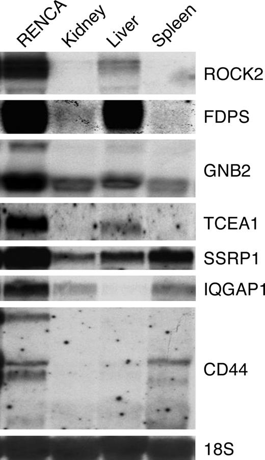 Figure 2. RENCA vaccine targets show enhanced expression in tumor cells compared with normal tissues. RNA was isolated from RENCA cells and normal kidney, liver, and spleen, and the transcript levels for multiple RENCA antigens were determined with northern analysis. The 18S ribosomal RNA served as a loading control.