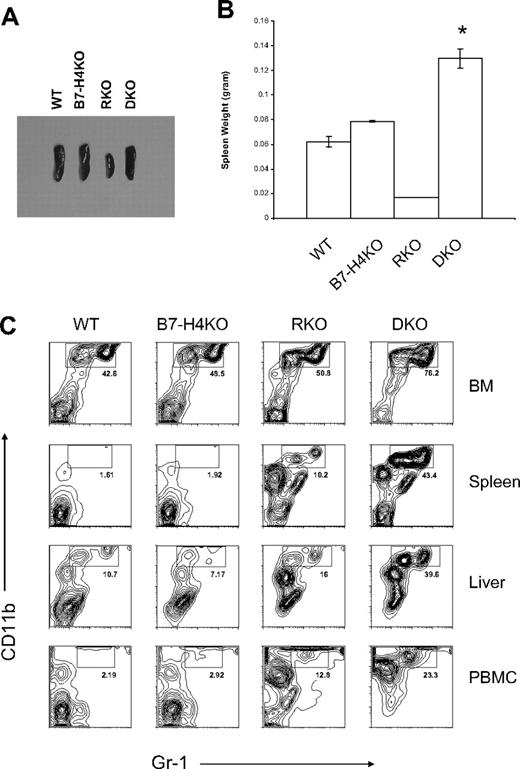 Figure 4. Phenotypes of B7-H4 × RAG-1 double KO mice (DKO). (A,B) Enlarged and increased weight of spleens from the DKO mice. Spleens were obtained from 6- to 8-week-old mice and the representatives of their appearance (A) and weights of average of 4 spleens (B) are shown. DKO indicates B7-H4 × RAG-1 double KO; RKO, RAG-1 KO; B7-H4 KO, B7-H4 KO mice in B6 background; and WT, normal B6. *P < .05. Error bars indicate SD (n = 3 mice). (C) Flow cytometric analysis of Gr-1+CD11b+ neutrophils in the absence of B7-H4. Cells were isolated from bone marrows, spleens, livers, and peripheral blood mononuclear cells (PBMCs) of indicated mice and stained with Gr-1 and CD11b mAb. Data were analyzed by flow cytometry.
