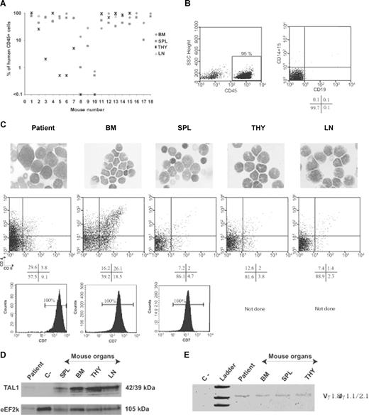 Figure 1. T-ALL development in NOD-Scid mice. Human T-ALL blasts were identified using CD45-specific antibodies and further characterized with myeloid and lymphoid subset-specific antibodies. Shown are representative results from a group of mice transplanted with the M18 T-ALL sample that carries a sil-tal interstitial deletion (Table 1, additional data). (A) Engraftment levels in the mouse hematopoietic organs. BM indicates bone marrow; SPL, spleen; THY, thymus; LN, lymph nodes. (B) Human B lymphoid and myeloid cells are absent from the BM of T-ALL–transplanted mice. Human CD45+ cells were gated according to isotype controls. Expression of CD19 B-cell marker or of CD15 myeloid cell marker was analyzed in the gated human CD45+ cell population. (C) May-Grünwald-Giemsa staining of cytospins (top panels). Slides were viewed with a laborlux 5 Leitz microscope (Leitz France, Rueil Malmaison, France) using Leitz microscope lens (oil immersion, ×25). Pictures were acquired using a Sony-CCD iris color video camera (Sony France, Paris, France) and images were processed using Adobe Photoshop software. CD4/CD8 (middle panels), and CD7 (bottom panels) expression analysis of gated human CD45+ cells engrafting different hematopoietic sites. Positivity bars were set according to isotype controls. Indicated are percentage of positive cells. ND indicates not done. (D) SCL/TAL1 protein levels in human cells engrafting different hematopoietic organs were determined using Western blot. eEF2k protein levels were used for loading normalization. Negative control (ie, C−) are proteins from cells (mouse + human) present in the spleen of a mouse transplanted with M22 T-ALL that does not express SCL/TAL1. (E) PCR analysis of γ-TCR gene rearrangements in the BM, THY, and SPL of a representative mouse transplanted with M18 T-ALL. Cells from patient were used in parallel. Negative (C−) control contained water.