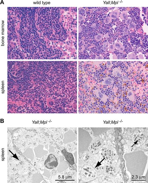 Figure 3. Abnormally high numbers of megakaryocytes and areas of packed platelets in bone marrow and spleen of Yall;Mpl−/− mice. (A) Sections of bone marrow and spleen show an increase in the number of megakaryocytes in Yall;Mpl−/− (right) compared with wild-type (left) mice. Aggregates of small platelet-like particles (brown color) are only found in Yall;Mpl−/− mice and are more prominent in the spleen. (B) Electron microscopy reveals densely packed platelets in spleen sections of Yall;Mpl−/− mice. Large arrows indicate the boundaries of platelets; the small arrow points at a dense granule within a platelet. No such platelet clusters were found in wild-type mice (data not shown). Images were taken using an Axioscope 2a microscope with a Planar Neofluar objective (40×/0.75 NA) and an AxioCam HR digital camera (all from Carl Zeiss, Jena, Germany). The software for image acquisition was AxioVision Rel. 4.6.