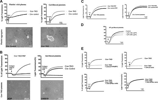 Figure 3. Plasma Fn inhibited Fg/VWF-independent platelet aggregation in vitro. (A top left) Platelet aggregation was enhanced in plasma Fn-depleted Cre+ TKO PRP compared with Cre− control PRP when stimulated by 500 μM TRAP (P < .05). (Top right) Gel-filtered platelet aggregation, induced by 1 U/mL thrombin, was also enhanced in Cre+ TKO mice (P < .05). (Bottom) The Cre+ TKO platelets formed larger aggregates than did Cre− control platelets when examined under a microscope. Pictures of aggregates were taken under a 10×/0.30 NA objective. (B) Platelet aggregation was induced in both Cre+ TKO PRP and gel-filtered platelets by collagen (5-10 μg/mL) but failed to be induced by ADP (20 μM) and U46619 (20 μM). No platelet aggregates were found in ADP- and U46619-treated Cre+ TKO samples when examined under a microscope (32×/0.40 NA objective). (C left) The enhancement of platelet aggregation in TKO conditions was diminished when Cre+ TKO platelets were aggregated in pFn-positive Cre− control PPP in a parallel aggregation assay (top panel). (Right) The enhancement of platelet aggregation by pFn was partially restored in Cre− control platelets when they were aggregated in pFn-depleted Cre+ TKO PPP. (D) Exogenous pFn significantly inhibited wild-type gel-filtered mouse platelet aggregation in a dose-dependent manner. (E top) Cre+ TKO platelet aggregation in PRP was inhibited by our newly generated mouse anti–mouse β3 integrin monoclonal antibody M1 (left). Cre+ TKO platelet aggregation with gel-filtered platelets in PIPES buffer was also inhibited by polyclonal anti-β3 integrin sera (right). (Bottom) Cre+ TKO platelet aggregation was not affected by a monoclonal antibody against GPIbα (left) and our mouse anti–mouse anti-GPIbα sera (right). All representative traces of platelet aggregation are shown from at least 3 independent experiments.